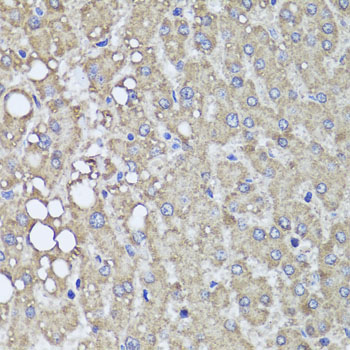 PIK3C2A Rabbit Polyclonal Antibody - Image 4