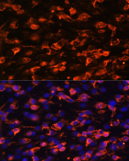 PIK3C2A Rabbit Polyclonal Antibody - Image 5