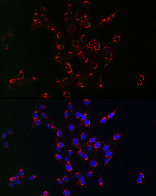 PIK3C3/VPS34 Rabbit Polyclonal Antibody - Image 2