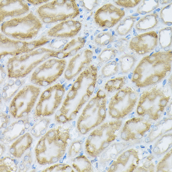 PIK3CA Rabbit Polyclonal Antibody - Image 2