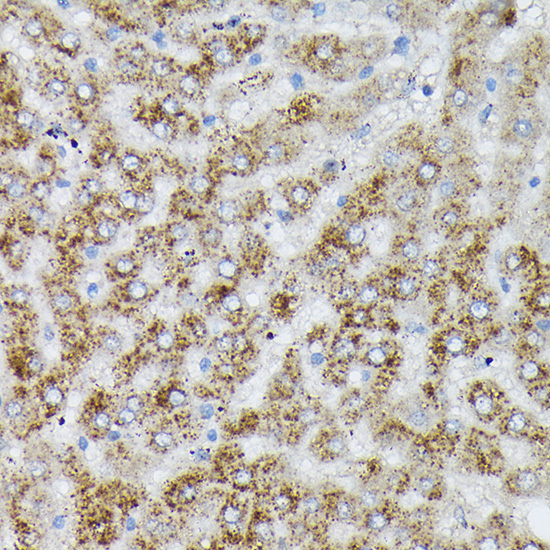 PIK3CA Rabbit Polyclonal Antibody - Image 3