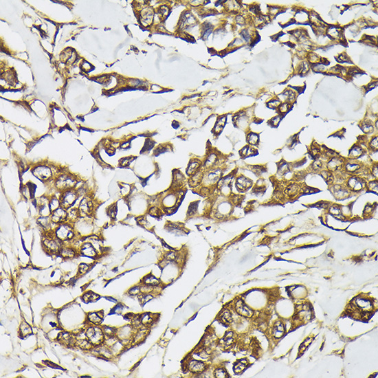 PIK3CA Rabbit Polyclonal Antibody - Image 4