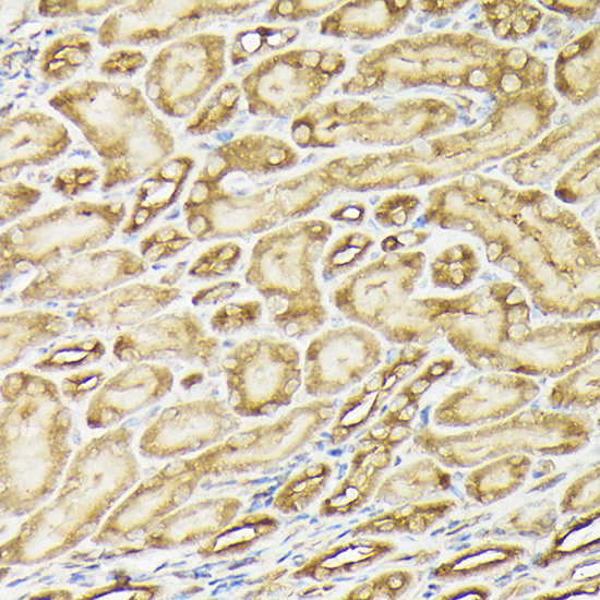 PIK3CA Rabbit Polyclonal Antibody - Image 5