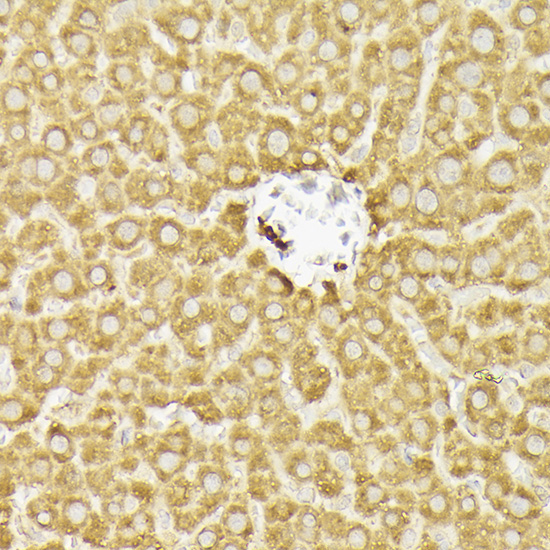 PIK3CA Rabbit Polyclonal Antibody - Image 6