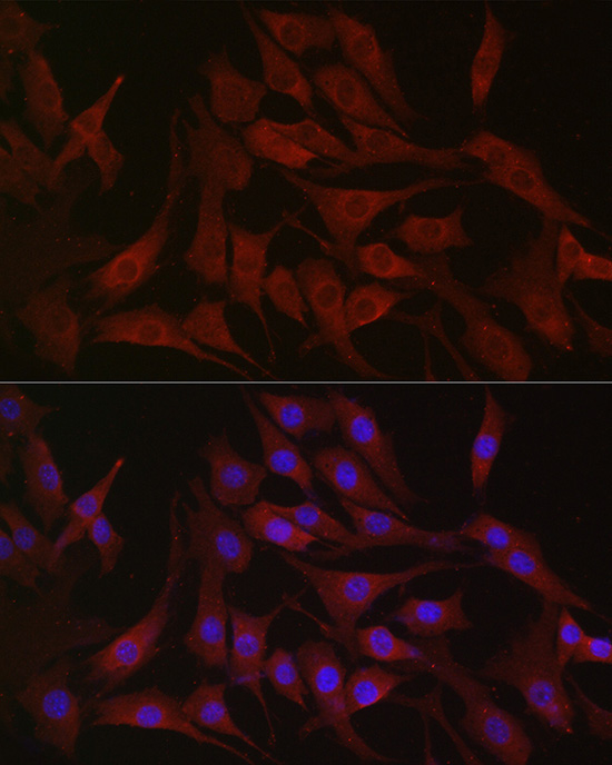PIK3CA Rabbit Polyclonal Antibody - Image 7