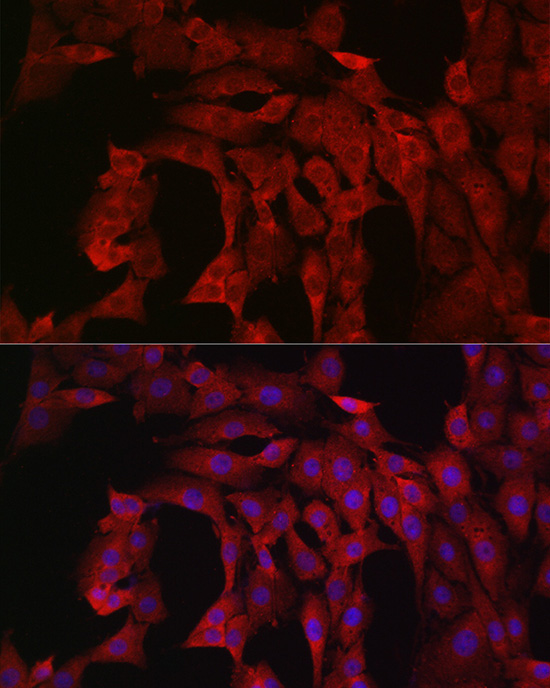 PIK3CA Rabbit Polyclonal Antibody - Image 8
