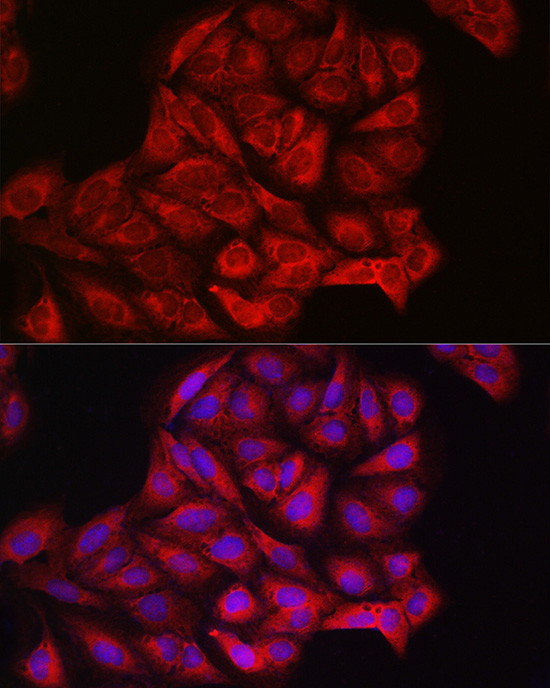 PIK3CA Rabbit Polyclonal Antibody - Image 9