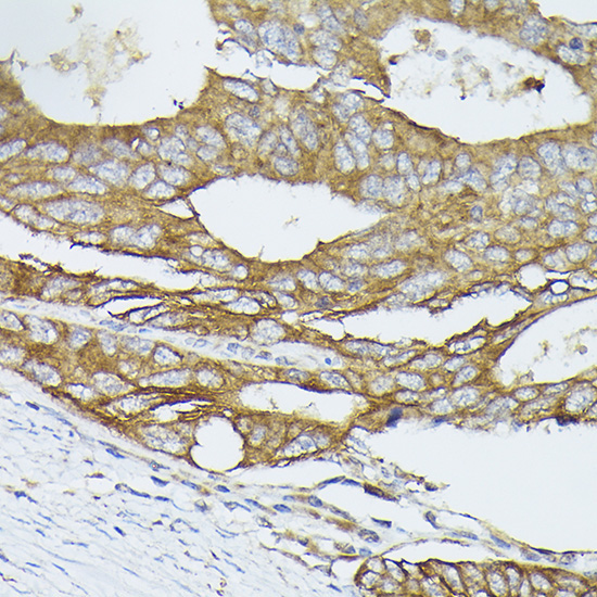 PIK3CA Rabbit Polyclonal Antibody - Image 3