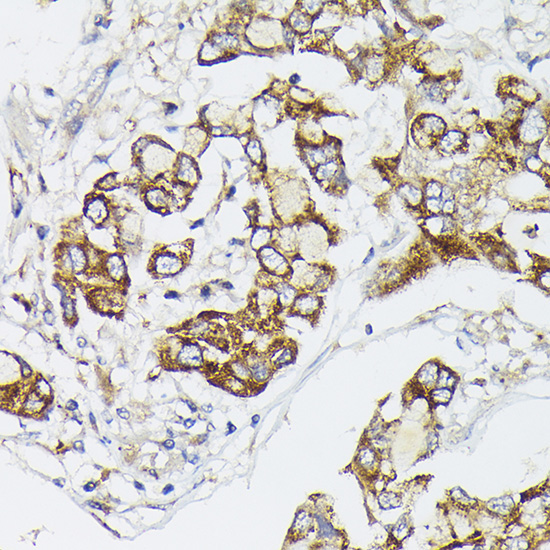 PIK3CA Rabbit Polyclonal Antibody - Image 4