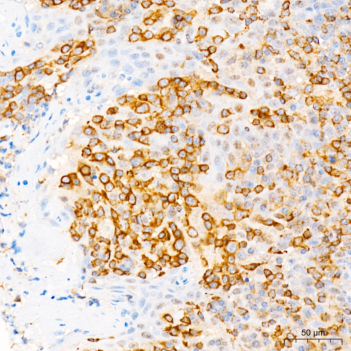 PIK3CG Rabbit Polyclonal Antibody