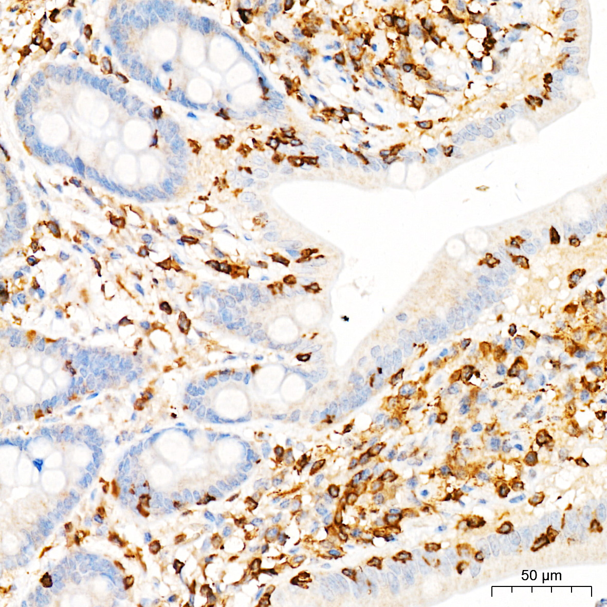 PIK3CG Rabbit Polyclonal Antibody - Image 2