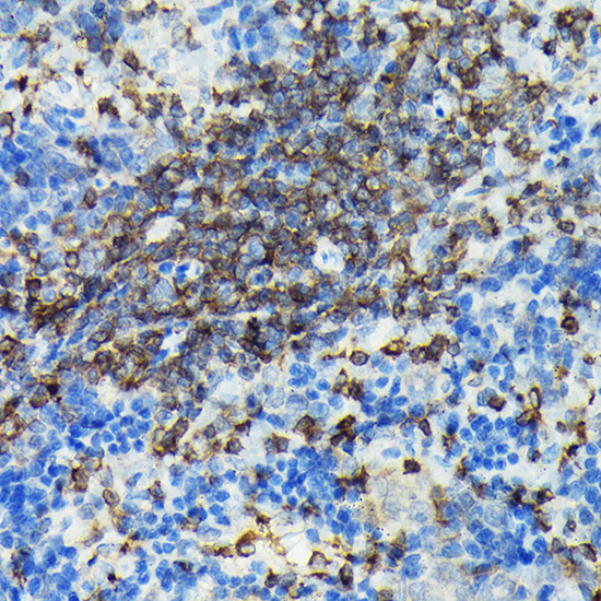 PIK3CG Rabbit Polyclonal Antibody - Image 2
