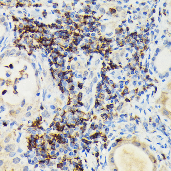 PIK3CG Rabbit Polyclonal Antibody - Image 3
