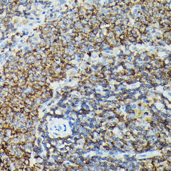 PIK3CG Rabbit Polyclonal Antibody - Image 4