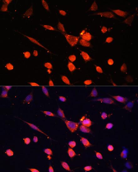 PIK3R3/p55PIK Rabbit Polyclonal Antibody - Image 2