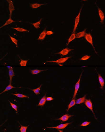 PIK3R3/p55PIK Rabbit Polyclonal Antibody - Image 2