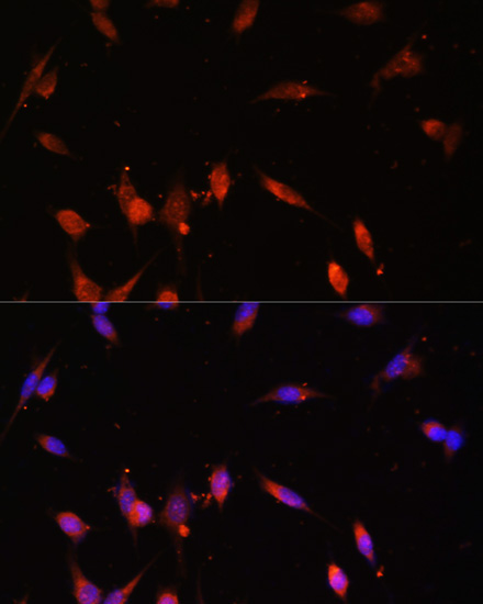PIK3R3/p55PIK Rabbit Polyclonal Antibody - Image 3