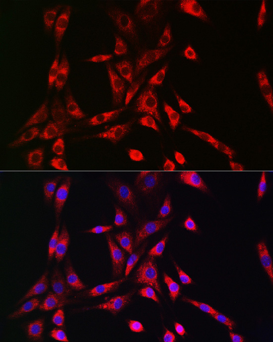 PIK3R4/VPS15 Rabbit Polyclonal Antibody - Image 2