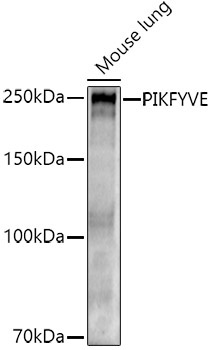 PIKFYVE Rabbit Polyclonal Antibody