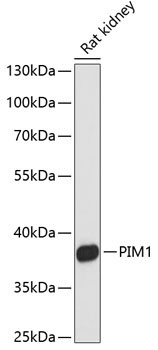 PIM1 Rabbit Polyclonal Antibody