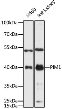 PIM1 Rabbit Polyclonal Antibody