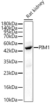 PIM1 Rabbit Polyclonal Antibody