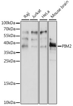 PIM2 Rabbit Polyclonal Antibody