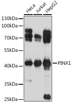 PINX1 Rabbit Polyclonal Antibody