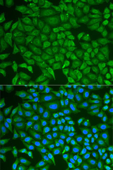 PIP Rabbit Polyclonal Antibody