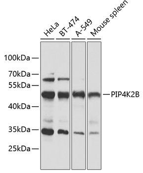 PIP4K2B Rabbit Polyclonal Antibody
