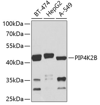 PIP4K2B Rabbit Polyclonal Antibody