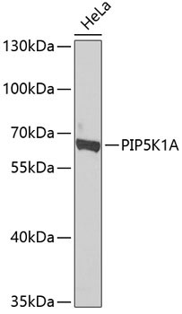PIP5K1A Rabbit Polyclonal Antibody