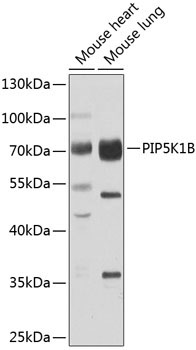 PIP5K1B Rabbit Polyclonal Antibody