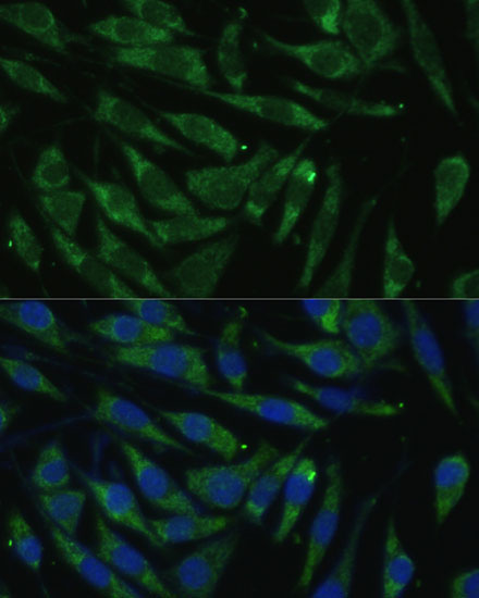 PITRM1 Rabbit Polyclonal Antibody - Image 2