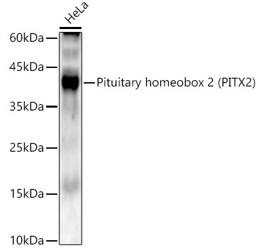 Pituitary homeobox 2 (PITX2) Rabbit Monoclonal Antibody