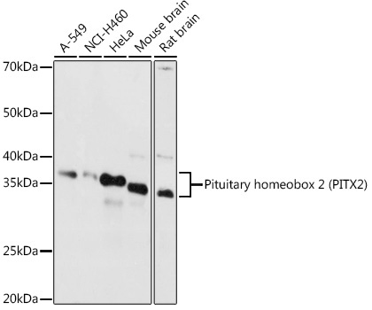 Pituitary homeobox 2 (PITX2) Rabbit Polyclonal Antibody