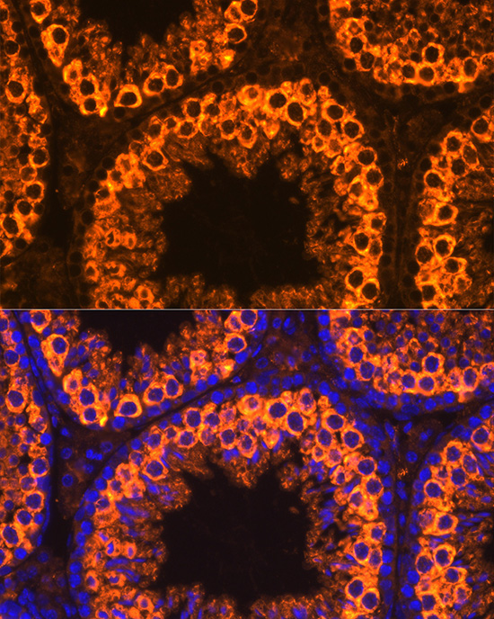 PIWIL1 Rabbit Polyclonal Antibody - Image 4