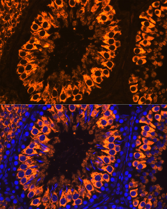 PIWIL1 Rabbit Polyclonal Antibody - Image 5