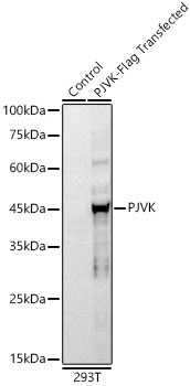 PJVK Rabbit Monoclonal Antibody