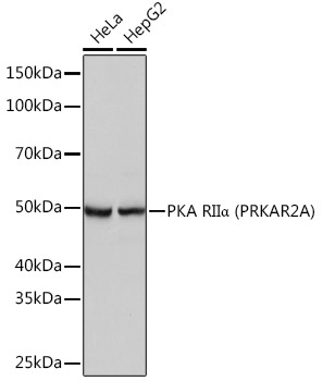 PKA RIIAlpha (PRKAR2A) Rabbit Monoclonal Antibody