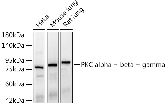 PKC alpha + beta + gamma Rabbit Monoclonal Antibody