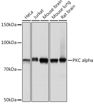 PKC alpha Rabbit Monoclonal Antibody