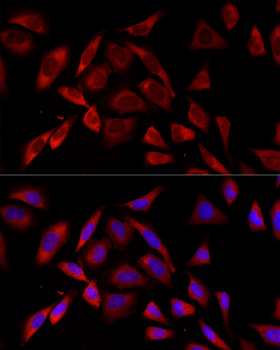 PKC alpha Rabbit Monoclonal Antibody