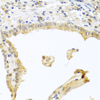 PKC alpha Rabbit Polyclonal Antibody - Image 2