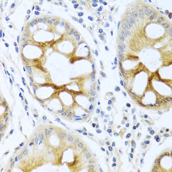 PKC alpha Rabbit Polyclonal Antibody - Image 3