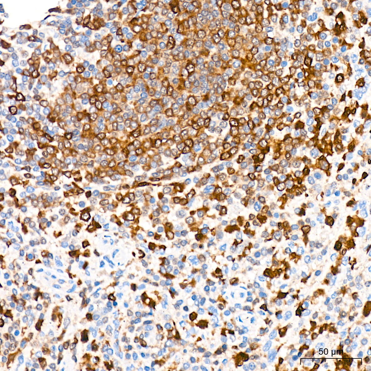 PKC delta Rabbit Monoclonal Antibody - Image 3