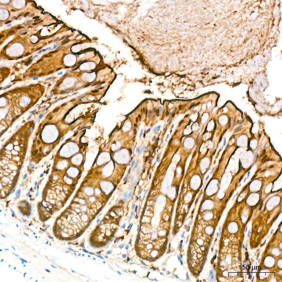 PKC delta Rabbit Monoclonal Antibody - Image 4