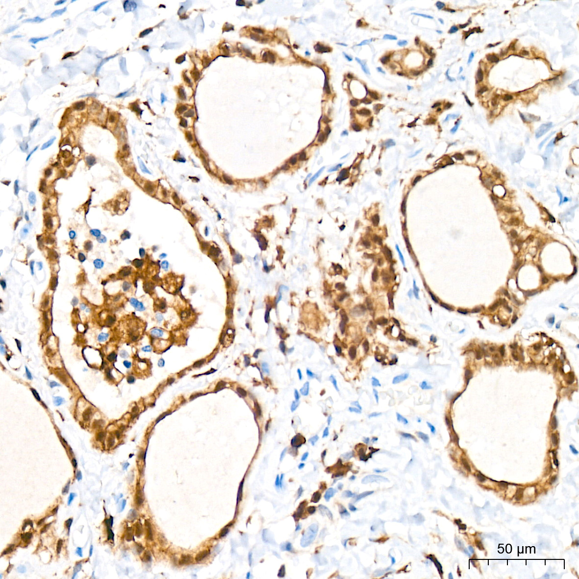 PKC delta Rabbit Monoclonal Antibody - Image 5