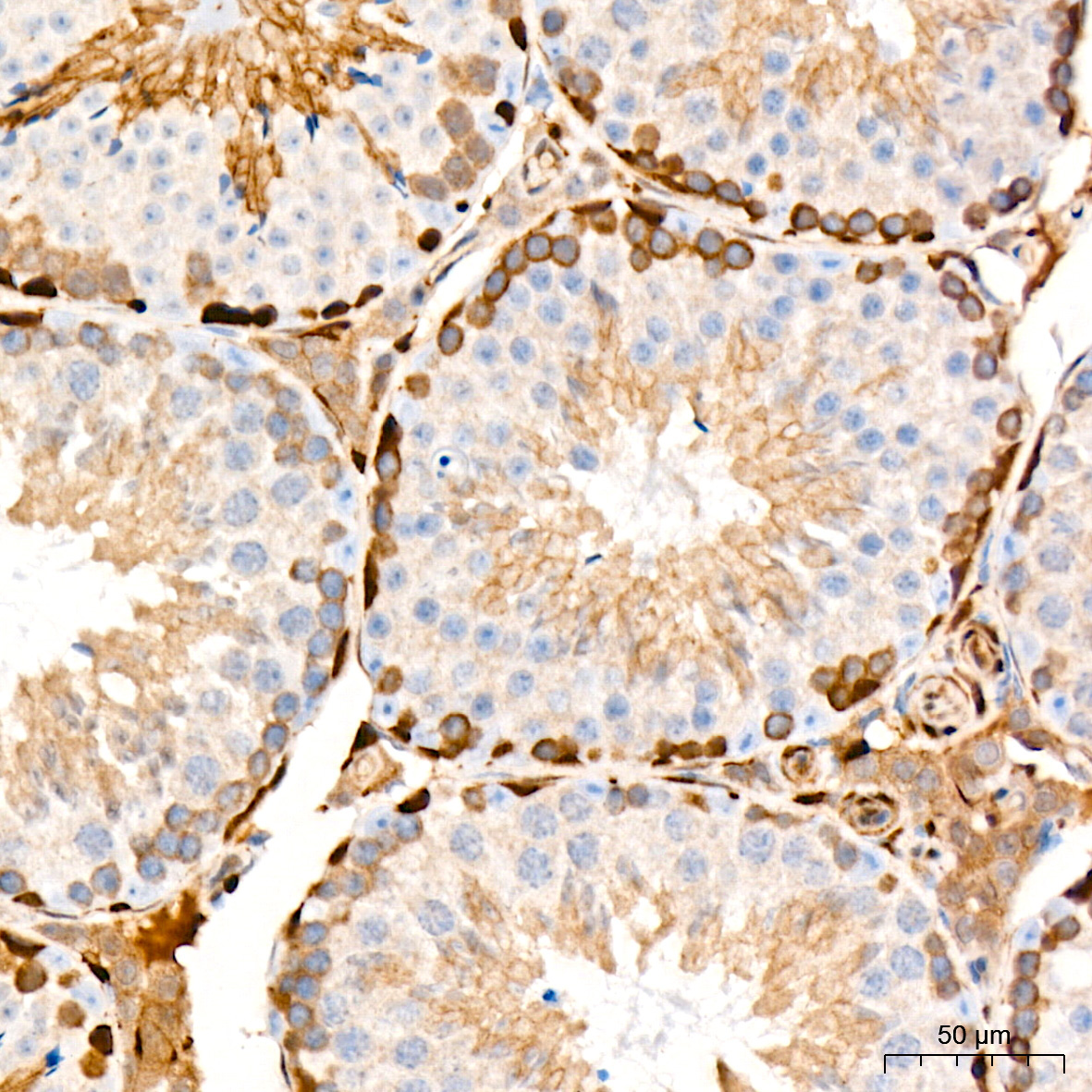 PKC delta Rabbit Monoclonal Antibody - Image 7