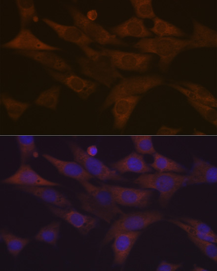 PKC delta Rabbit Monoclonal Antibody - Image 8
